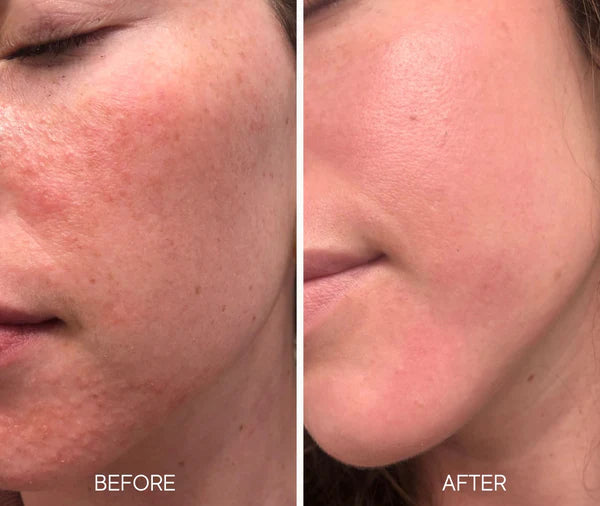 Lumielle Glass Skin Liquid Exfoliant