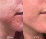 Lumielle Glass Skin Liquid Exfoliant