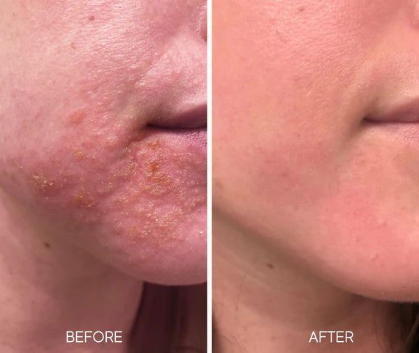 Lumielle Glass Skin Liquid Exfoliant