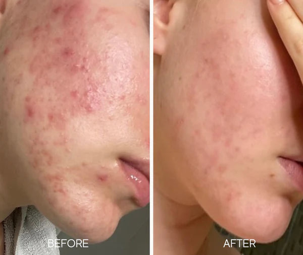 Lumielle Glass Skin Liquid Exfoliant