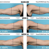 Alastin TransFORM Body Treatment with TriHex Technology
